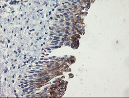 IHC of paraffin-embedded Human bladder tissue using anti-SLA2 mouse monoclonal antibody.