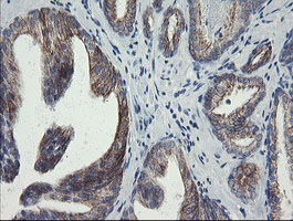 IHC of paraffin-embedded Human prostate tissue using anti-SLA2 mouse monoclonal antibody.