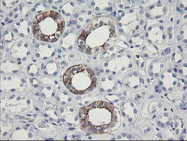IHC of paraffin-embedded Human Kidney tissue using anti-SLA2 mouse monoclonal antibody.