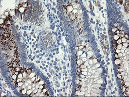 IHC of paraffin-embedded Human colon tissue using anti-SLA2 mouse monoclonal antibody.
