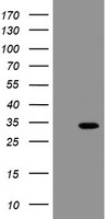 HEK293T cells were transfected with the pCMV6-ENTRY control (Left lane) or pCMV6-ENTRY SLA2 (Right lane) cDNA for 48 hrs and lysed. Equivalent amounts of cell lysates (5 ug per lane) were separated by SDS-PAGE and immunoblotted with anti-SLA2.