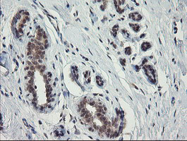 IHC of paraffin-embedded Human breast tissue using anti-SLA2 mouse monoclonal antibody. (Heat-induced epitope retrieval by 10mM citric buffer, pH6.0, 100C for 10min).