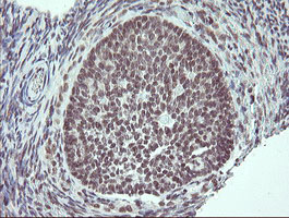 IHC of paraffin-embedded Human Ovary tissue using anti-SLA2 mouse monoclonal antibody. (Heat-induced epitope retrieval by 10mM citric buffer, pH6.0, 100C for 10min).