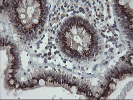 IHC of paraffin-embedded Human colon tissue using anti-SLA2 mouse monoclonal antibody. (Heat-induced epitope retrieval by 10mM citric buffer, pH6.0, 100C for 10min).