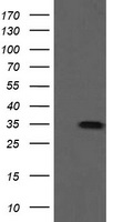 HEK293T cells were transfected with the pCMV6-ENTRY control (Left lane) or pCMV6-ENTRY SLA2 (Right lane) cDNA for 48 hrs and lysed. Equivalent amounts of cell lysates (5 ug per lane) were separated by SDS-PAGE and immunoblotted with anti-SLA2.