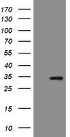HEK293T cells were transfected with the pCMV6-ENTRY control (Left lane) or pCMV6-ENTRY SLA2 (Right lane) cDNA for 48 hrs and lysed. Equivalent amounts of cell lysates (5 ug per lane) were separated by SDS-PAGE and immunoblotted with anti-SLA2.