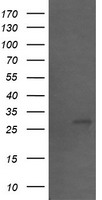 HEK293T cells were transfected with the pCMV6-ENTRY control (Left lane) or pCMV6-ENTRY SLA2 (Right lane) cDNA for 48 hrs and lysed. Equivalent amounts of cell lysates (5 ug per lane) were separated by SDS-PAGE and immunoblotted with anti-SLA2.