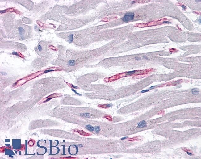Anti-SLAIN1 antibody IHC of human heart. Immunohistochemistry of formalin-fixed, paraffin-embedded tissue after heat-induced antigen retrieval. Antibody LS-B4721 concentration 5 ug/ml.