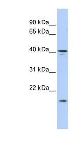 SLAIN1 antibody LS-C102449 Western blot of HepG2 cell lysate.