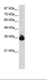HepG2 Cell Lysate