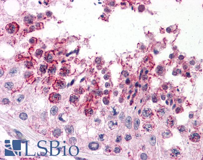 Anti-SLAIN2 antibody IHC of human testis. Immunohistochemistry of formalin-fixed, paraffin-embedded tissue after heat-induced antigen retrieval. Antibody LS-B4722 concentration 5 ug/ml.
