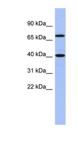SLAIN2 antibody LS-C110924 Western blot of Fetal Thymus lysate.