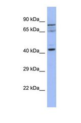 Western blot of Human HepG2. SLAIN2 antibody dilution 1.0 ug/ml.