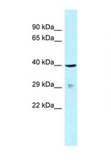 SLAMF1 / SLAM / CD150 antibody LS-C145896 Western blot of 721_B Cell lysate. Antibody concentration 1 ug/ml.