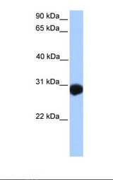 Placenta lysate. Antibody concentration: 1.0 ug/ml. Gel concentration: 12%.