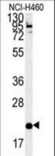 SLAMF7 Antibody western blot of NCI-H460 cell line lysates (35 ug/lane). The SLAMF7 antibody detected the SLAMF7 protein (arrow).