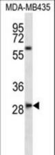 SLAMF8 Antibody western blot of MDA-MB435 cell line lysates (35 ug/lane). The SLAMF8 antibody detected the SLAMF8 protein (arrow).