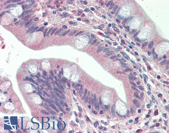 Human, Small intestine: Formalin-Fixed Paraffin-Embedded (FFPE)