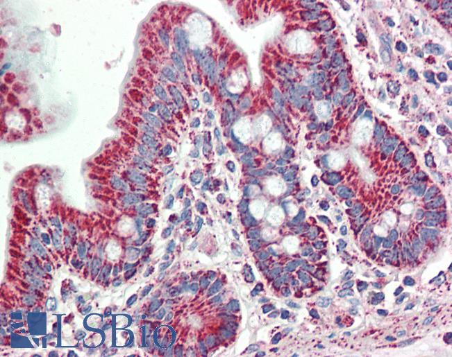 Human, Small intestine: Formalin-Fixed Paraffin-Embedded (FFPE)