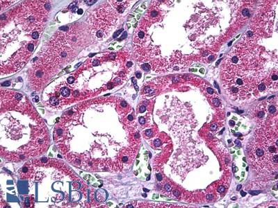 Anti-SLC11A2 antibody IHC of human kidney. Immunohistochemistry of formalin-fixed, paraffin-embedded tissue after heat-induced antigen retrieval. Antibody LS-B5484 concentration 5 ug/ml.