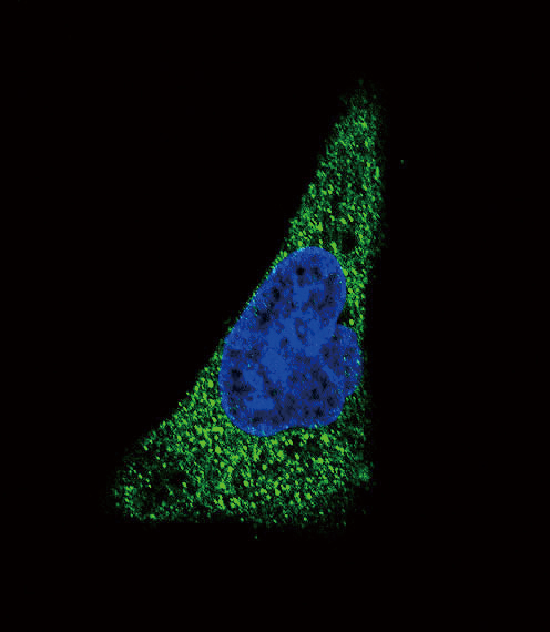 Confocal immunofluorescent of SLC11A2 Antibody with HepG2 cell followed by Alexa Fluor 488-conjugated goat anti-rabbit lgG (green). DAPI was used to stain the cell nuclear (blue).