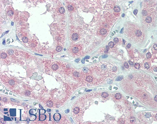 Anti-SLC11A2 antibody LS-A9282 IHC of human kidney. Immunohistochemistry of formalin-fixed, paraffin-embedded tissue after heat-induced antigen retrieval.