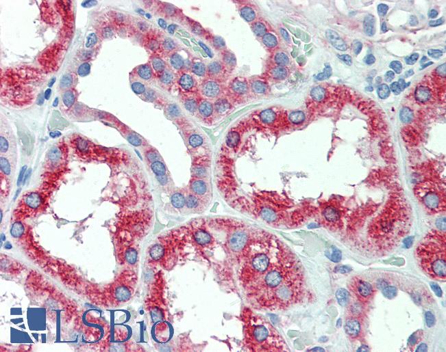 Anti-SLC11A2 antibody LS-A9281 IHC of human, kidney. Immunohistochemistry of formalin-fixed, paraffin-embedded tissue after heat-induced antigen retrieval.