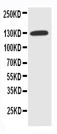 WB of SLC12A2 / NKCC1 antibody. WB: HELA Cell Lysate.
