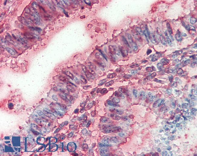Anti-SLC12A2 / NKCC1 antibody LS-A8903 IHC of human uterus. Immunohistochemistry of formalin-fixed, paraffin-embedded tissue after heat-induced antigen retrieval.