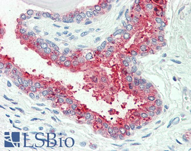 Anti-SLC12A2 / NKCC1 antibody LS-A8903 IHC of human prostate. Immunohistochemistry of formalin-fixed, paraffin-embedded tissue after heat-induced antigen retrieval.