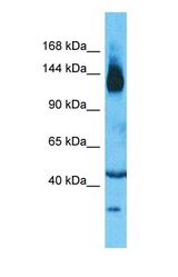 Western blot of SLC12A2 Antibody with human Thymus Tumor lysate.