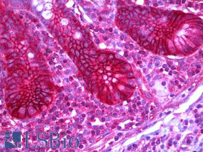 Anti-SLC12A2 / NKCC1 antibody IHC of human small intestine. Immunohistochemistry of formalin-fixed, paraffin-embedded tissue after heat-induced antigen retrieval. Antibody LS-B6385 concentration 5 ug/ml.