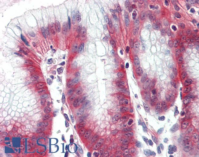 Human, Stomach: Formalin-Fixed Paraffin-Embedded (FFPE)