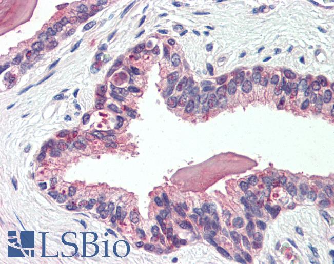 Human, Prostate: Formalin-Fixed Paraffin-Embedded (FFPE)