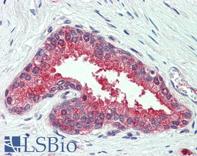 Anti-SLC12A2 / NKCC1 antibody LS-A8899 IHC of human prostate. Immunohistochemistry of formalin-fixed, paraffin-embedded tissue after heat-induced antigen retrieval.
