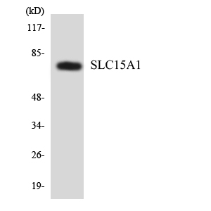 Western blot of the lysates from HeLa cells using SLC15A1 antibody.