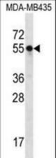 SLC15A3 Antibody western blot of MDA-MB435 cell line lysates (35 ug/lane). The SLC15A3 antibody detected the SLC15A3 protein (arrow).