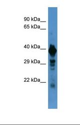 Western blot of Human Hela . SLC18A1 antibody dilution 1.0 ug/ml.