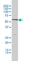 SLC18A1 monoclonal antibody (M01), clone 3A2-E10 Western Blot analysis of SLC18A1 expression in A-549.