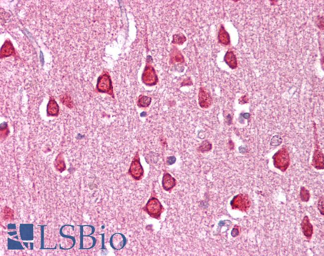 Anti-SLC18A1 / VMAT1 antibody IHC of human brain-cortex. Immunohistochemistry of formalin-fixed, paraffin-embedded tissue after heat-induced antigen retrieval. Antibody LS-B6611 concentration 2.5 ug/ml.