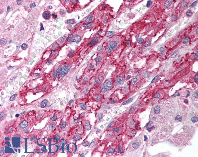 Anti-SLC18A1 / VMAT1 antibody IHC of human adrenal. Immunohistochemistry of formalin-fixed, paraffin-embedded tissue after heat-induced antigen retrieval. Antibody LS-B1189 concentration 5 ug/ml.