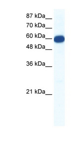 SLC18A1 / VMAT1 antibody LS-B1189 Western blot of Jurkat lysate.