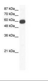 Jurkat Cell Lysate