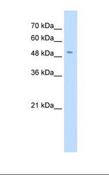 Jurkat cell lysate. Antibody concentration: 0.5 ug/ml. Gel concentration: 12%.