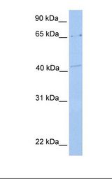 721_B cell lysate. Antibody concentration: 1.0 ug/ml. Gel concentration: 12%.