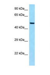SLC19A2 antibody LS-C146133 Western blot of Fetal Heart lysate. Antibody concentration 1 ug/ml.