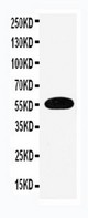 EAAT3 antibody Western blot. WB: Human Placenta Tissue Lysate.
