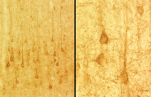 IHC: Mouse anti-Glutamate Transporter [EAAC1] (LS-C152890) staining of rat cerebral cortex.