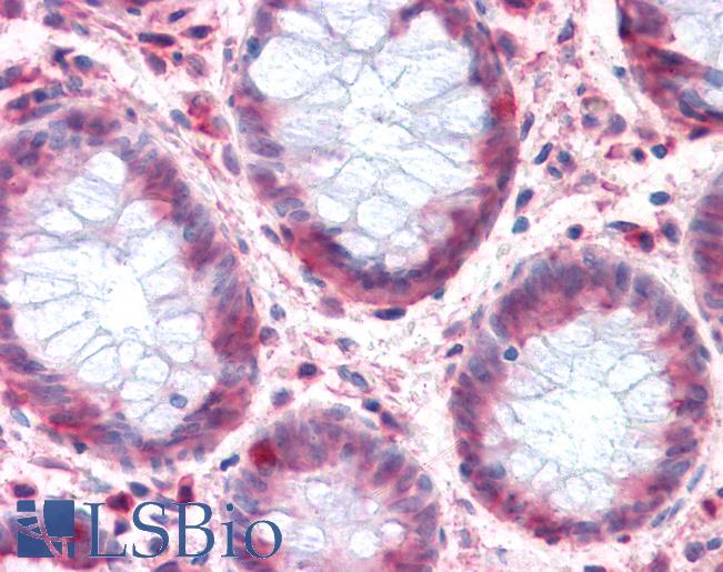 Anti-SLC1A4 antibody LS-A8979 IHC of human colon. Immunohistochemistry of formalin-fixed, paraffin-embedded tissue after heat-induced antigen retrieval.