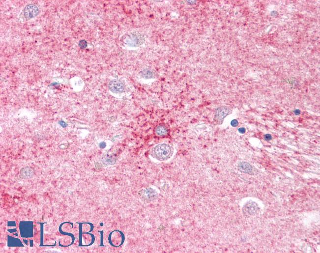 Anti-SLC1A4 antibody LS-A8978 IHC of human brain, basal ganglia. Immunohistochemistry of formalin-fixed, paraffin-embedded tissue after heat-induced antigen retrieval.